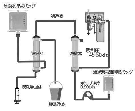 胸水腹水濾過濃縮再静注法業務